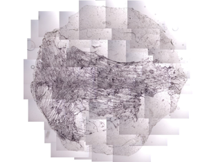 製品候補のひとつである血管内皮細胞シート